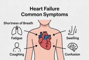 Heart Failure Common Symptoms