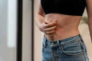 skin problems from leaky gut